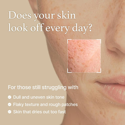 I’m From Rice Toner for Sensitive Skin – Hydrating K-Beauty Essence with Niacinamide & Rice Extract, Alcohol-Free, Vegan, Fragrance-Free (5.07 fl oz)