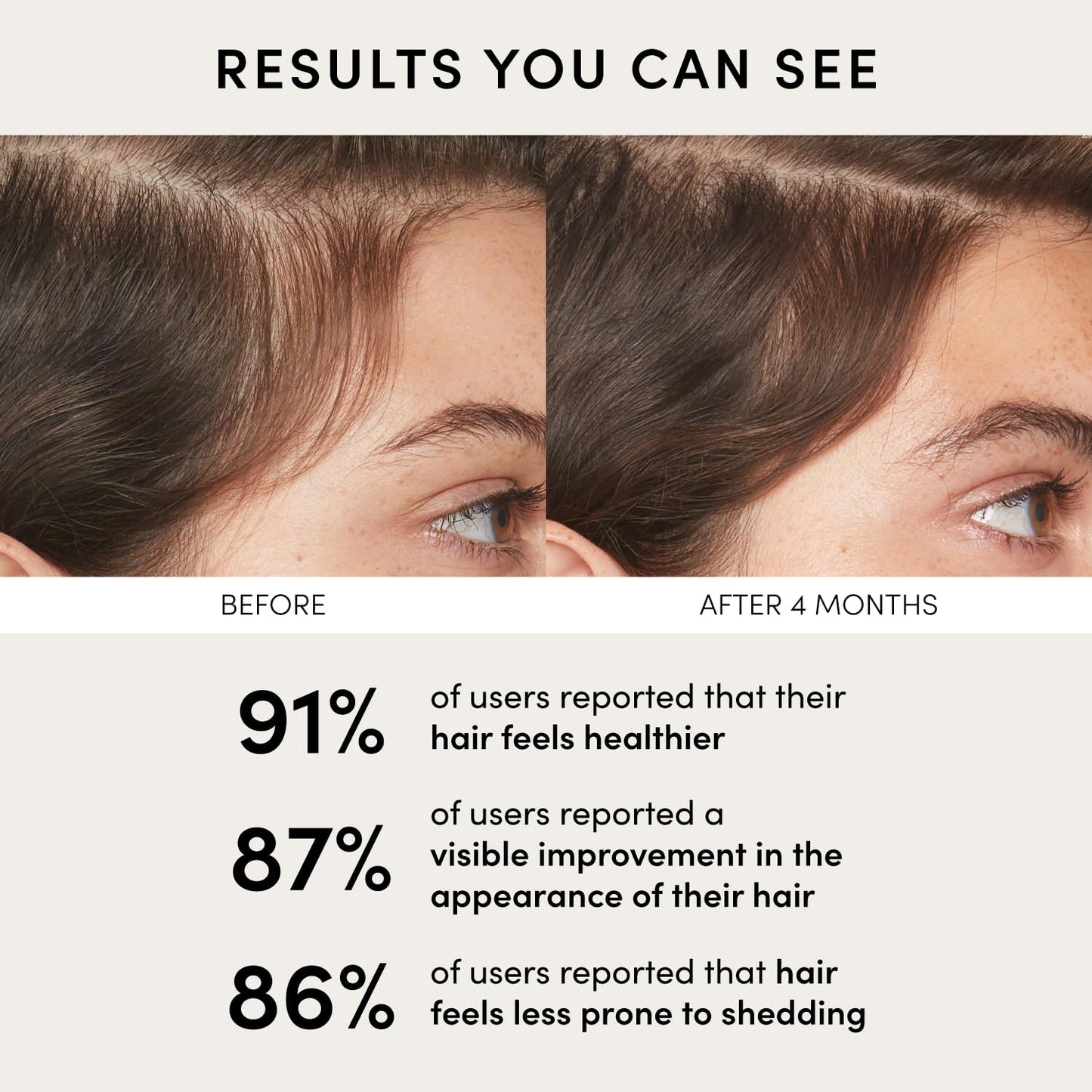 OUAI Scalp Serum – Balancing Hair Serum