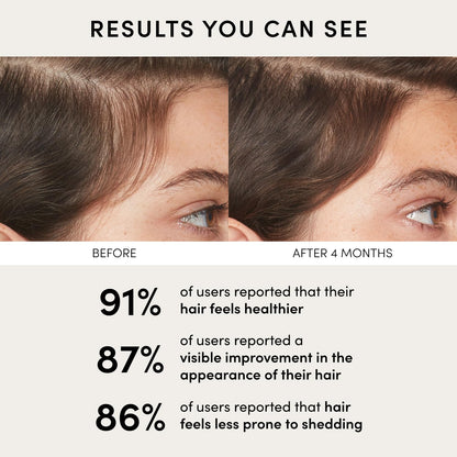 OUAI Scalp Serum – Balancing Hair Serum