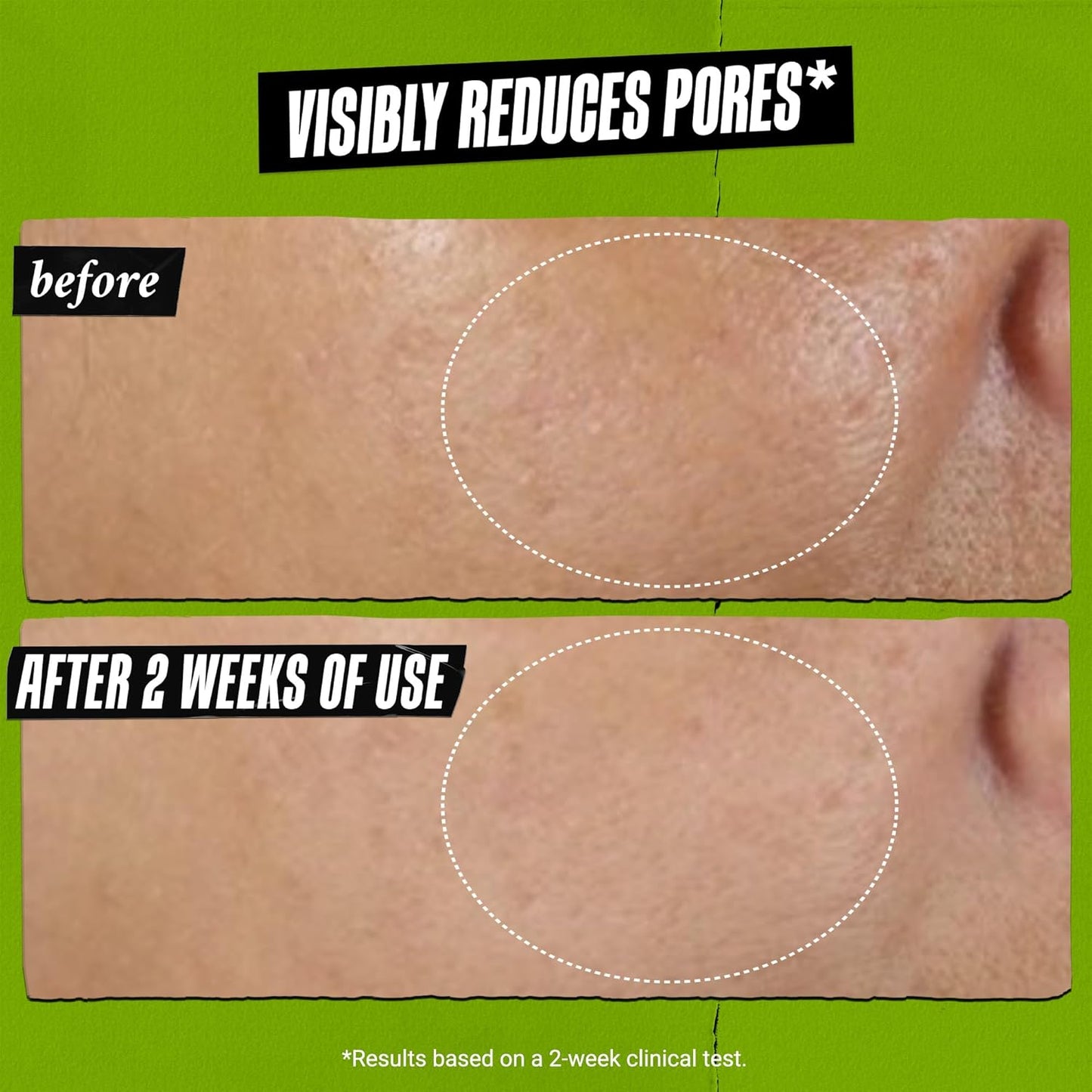 Kiehl’s Rare Earth Deep Pore Cleansing Mask – Oil-Minimizing, Detoxifying Face Mask with Amazonian White Clay & Aloe Vera