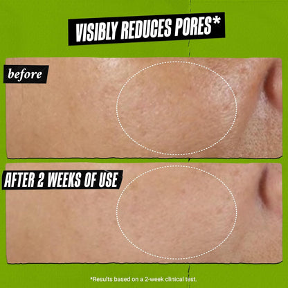 Kiehl’s Rare Earth Deep Pore Cleansing Mask – Oil-Minimizing, Detoxifying Face Mask with Amazonian White Clay & Aloe Vera