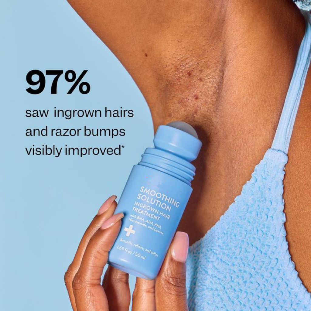 Ingrown Hair Treatment for Women – Bump-Reducing & Smoothing Solution