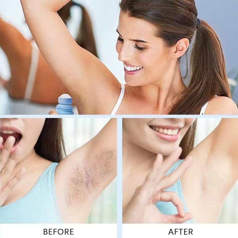 Ingrown Hair Treatment for Women – Bump-Reducing & Smoothing Solution